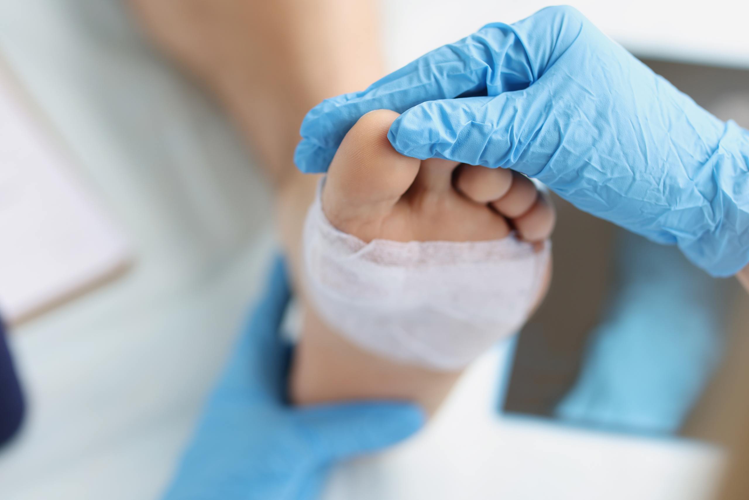 CGS Local Coverage Determination Places New Limits on Use of Skin Substitutes